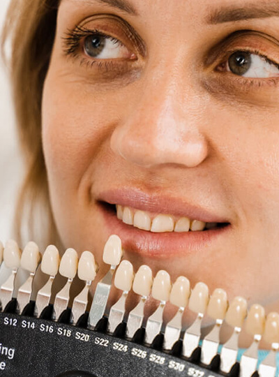 Porcelain Veneers Cropped Cosmetic Dentistry