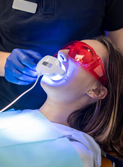Teeth Whitening Cropped Cosmetic Dentistry