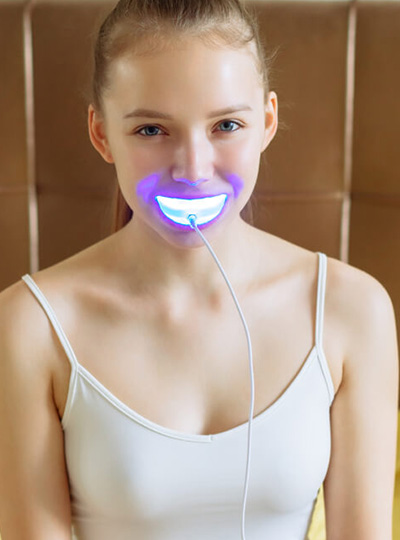 Teeth Whitening Kits Cropped Cosmetic Dentistry