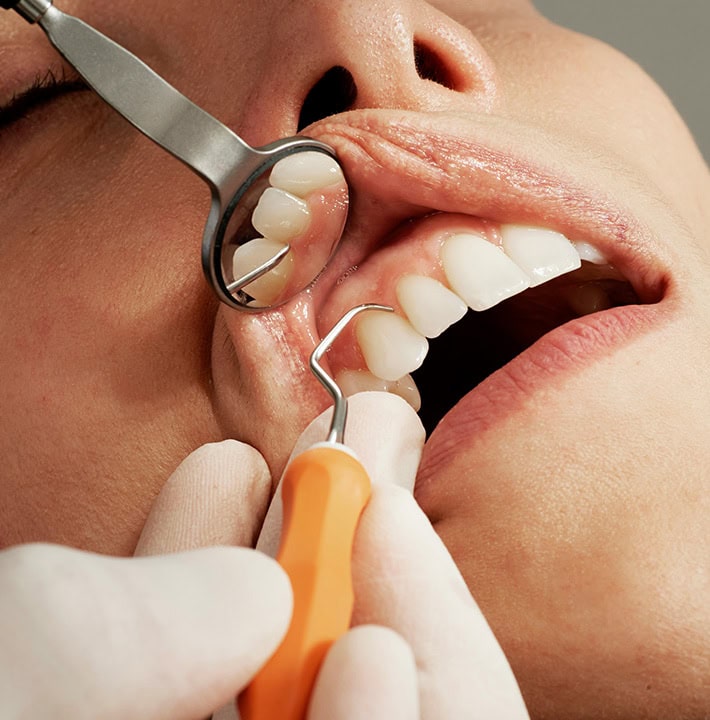 Mirror and clean Dentist in Highgate