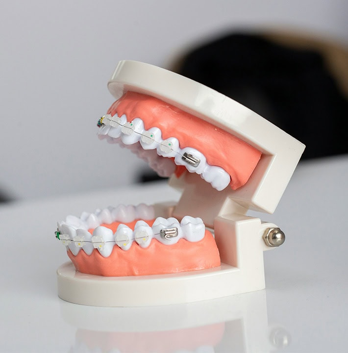 Dianella Teeth Dentist in Dianella