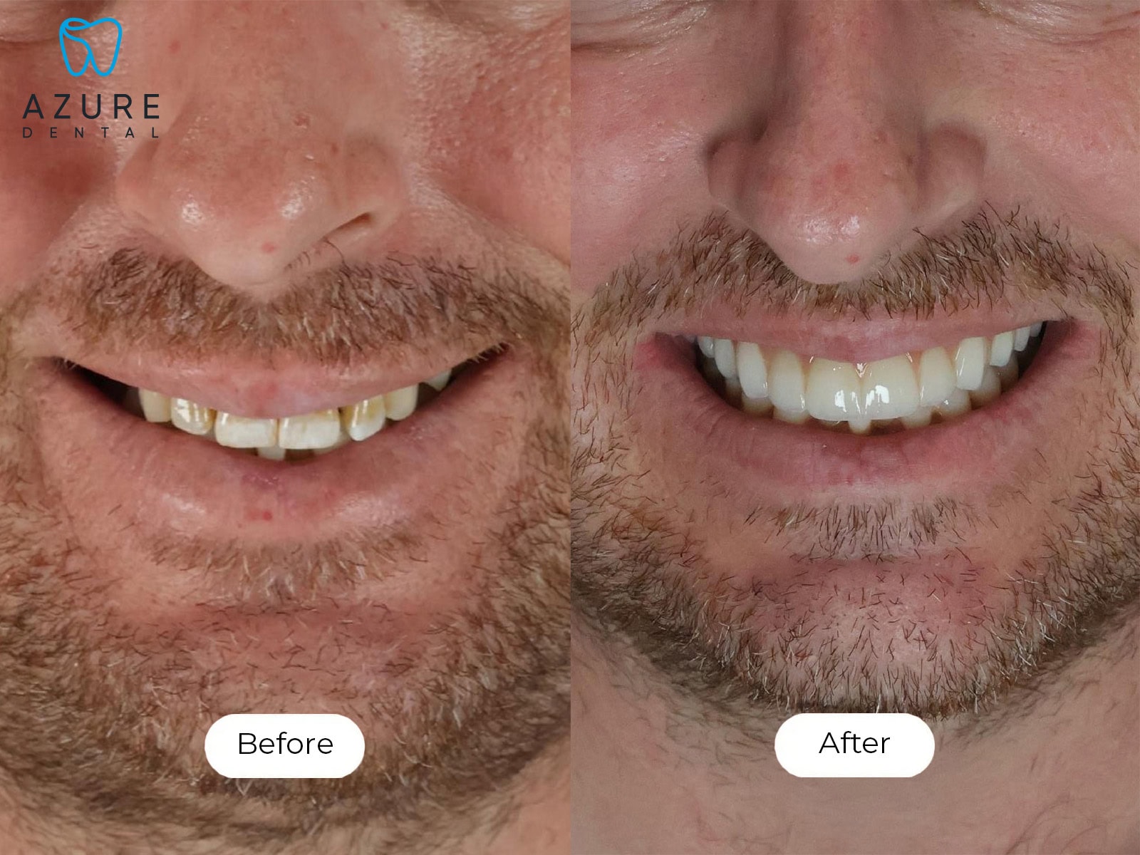Anthony Smile Gallery
