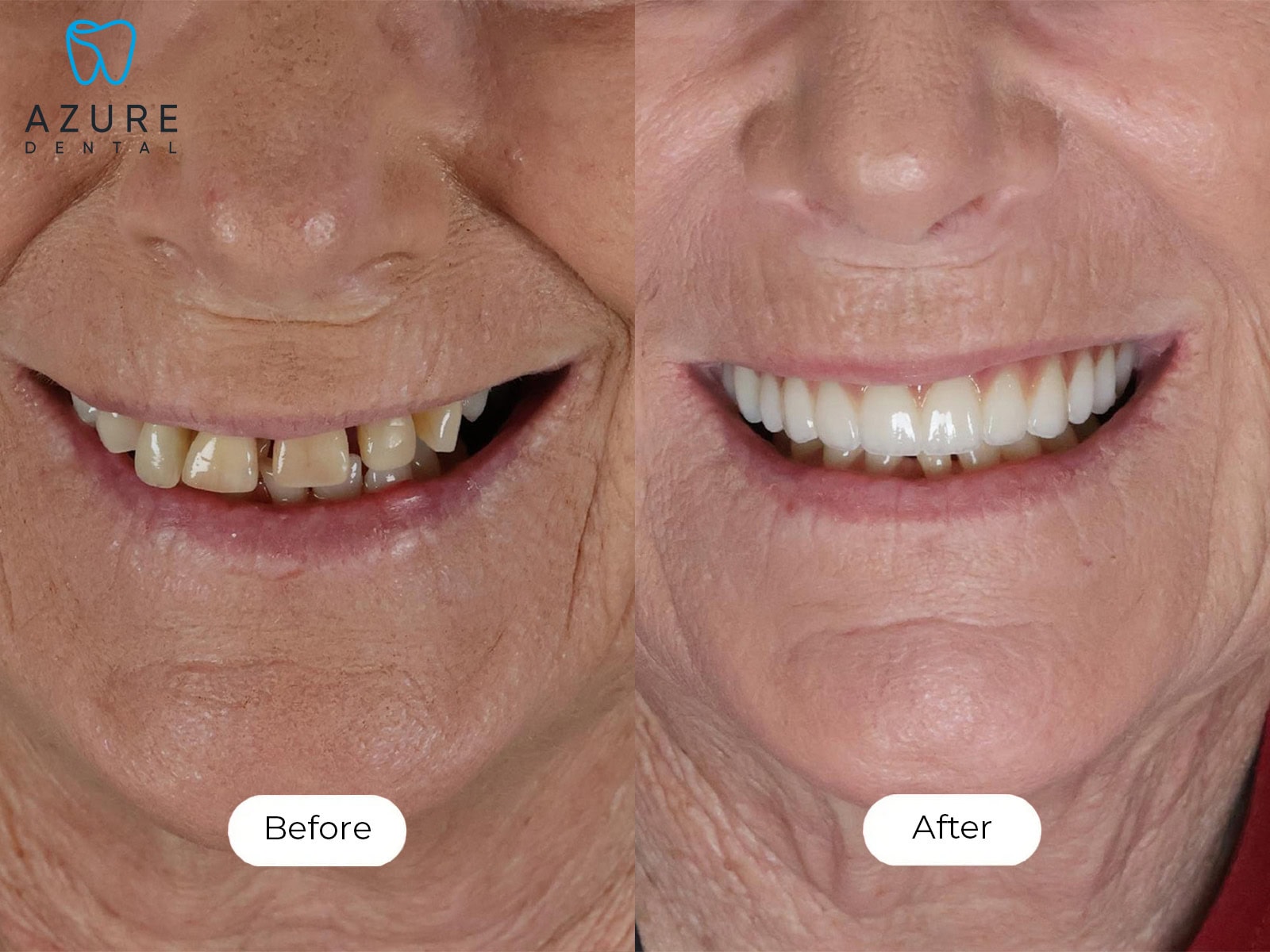 Bernadine Smile Gallery