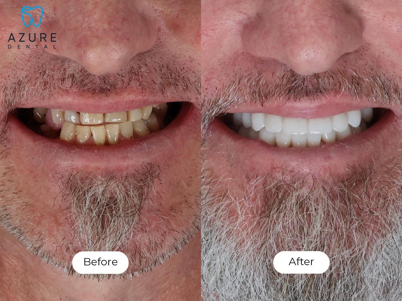 Garth Smile Gallery