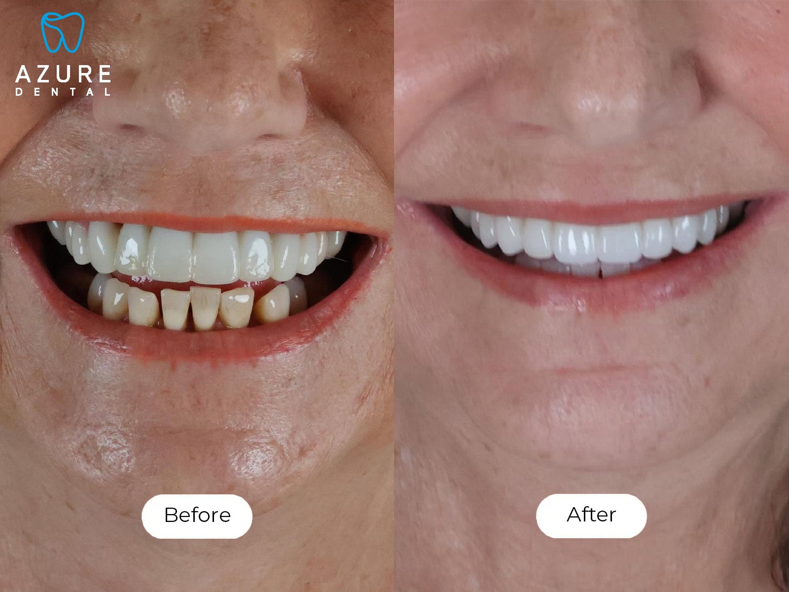Kathy Smile Gallery