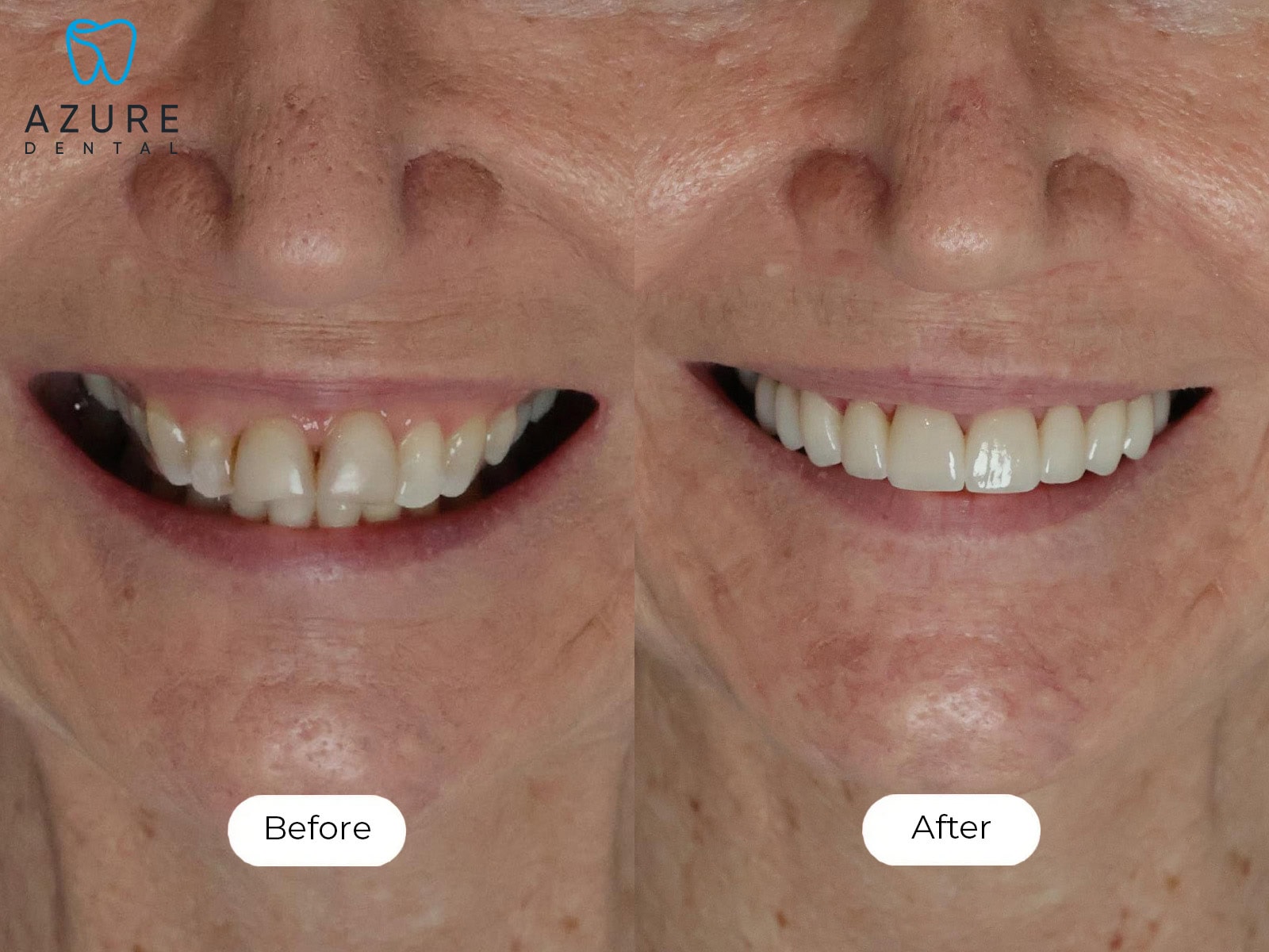 Sandi Smile Gallery